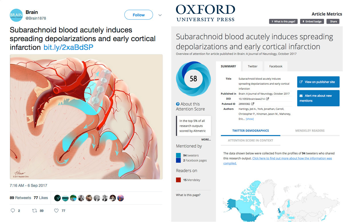 brain medical illustration stroke research