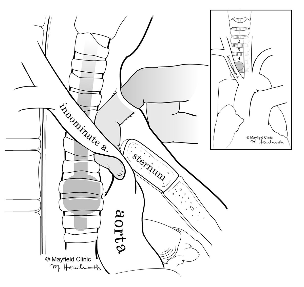 anatomy medical illustration artery larynx skull