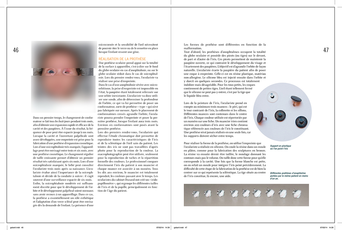 medical eyes microphtalmy anophtalmy eye-socket iris book Layout edition PUPIL