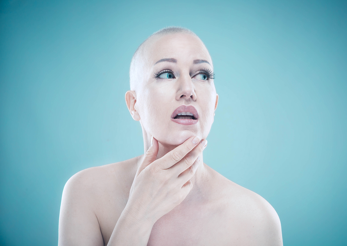 bald beauty breast cancer cancer hairloss Health model Photography  self portrait woman