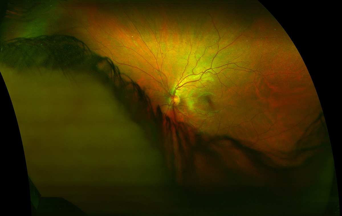 eye scan xray body science Interior inside Health healthy veins