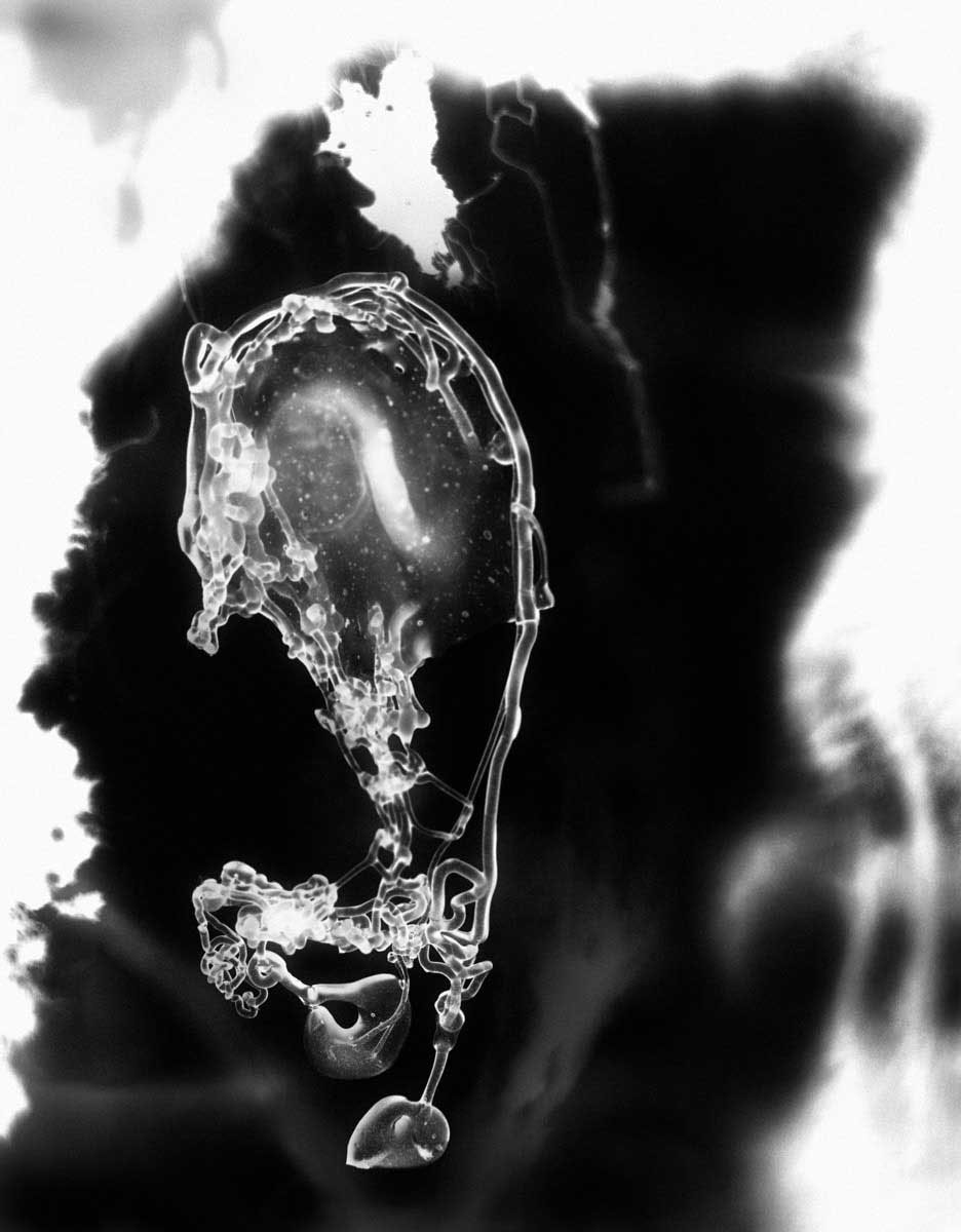 fetus black & white