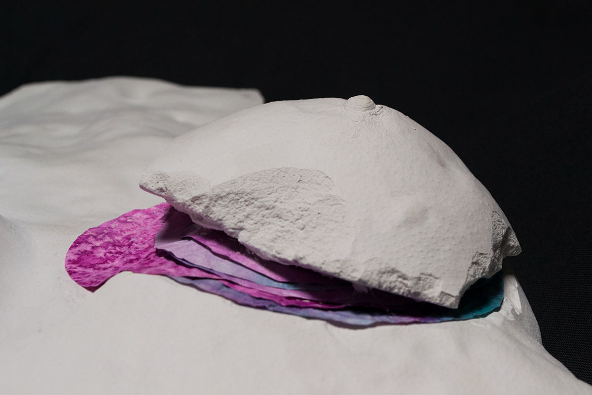 cancer Plâtre sculpture Moulage ablation reconstruction mammaire