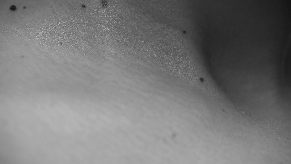 skin selfportrait black and white