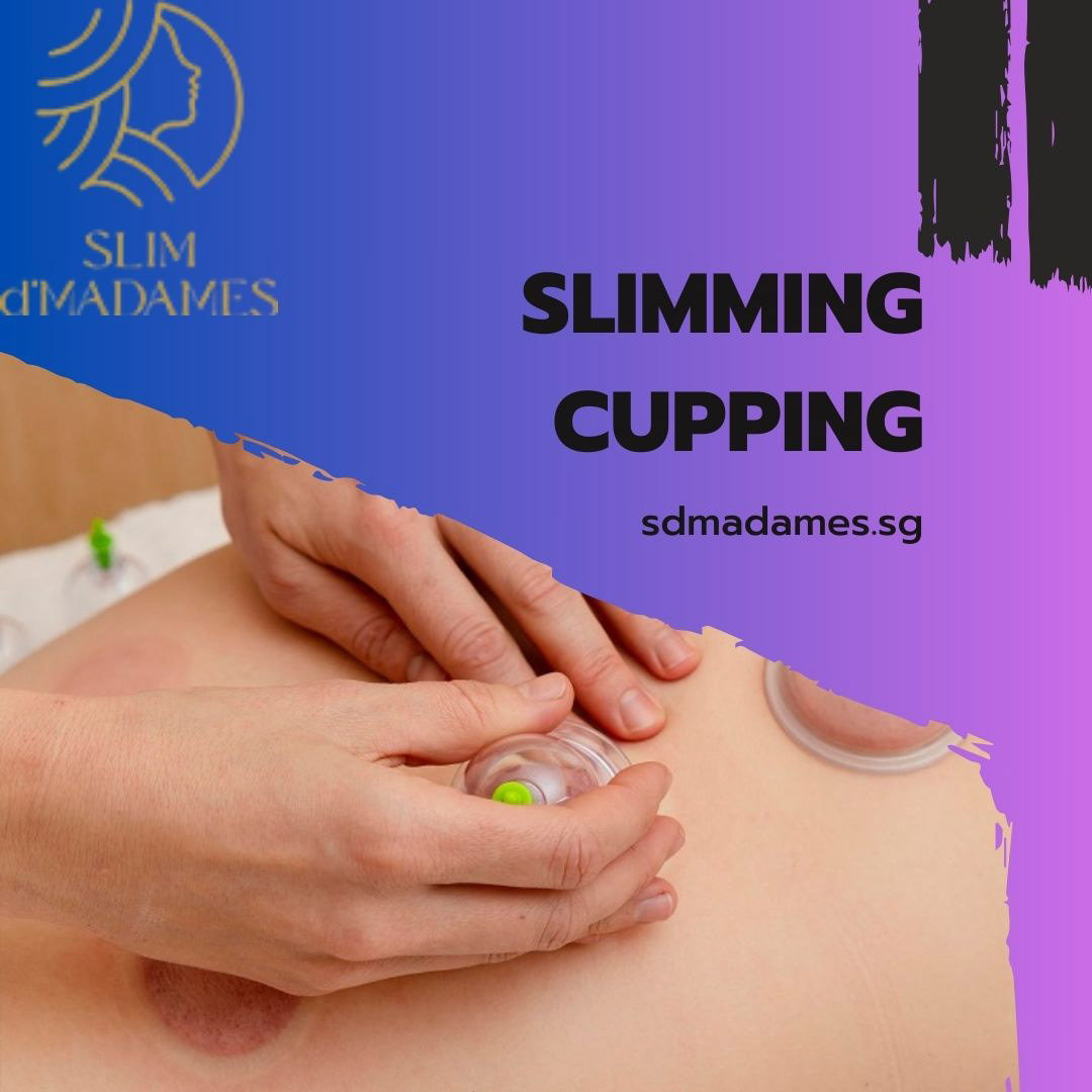 slimming cupping