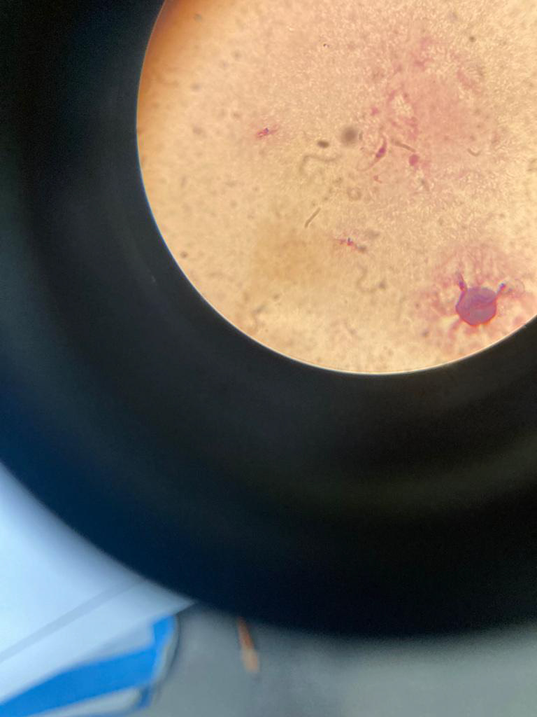 microscope microscopic Trypanosoma cruzi