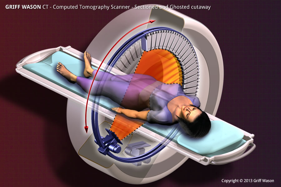 Medical Scanners mri ct scanner PET Scanner Positron Emission Tomography Computed Tomography Cutaways