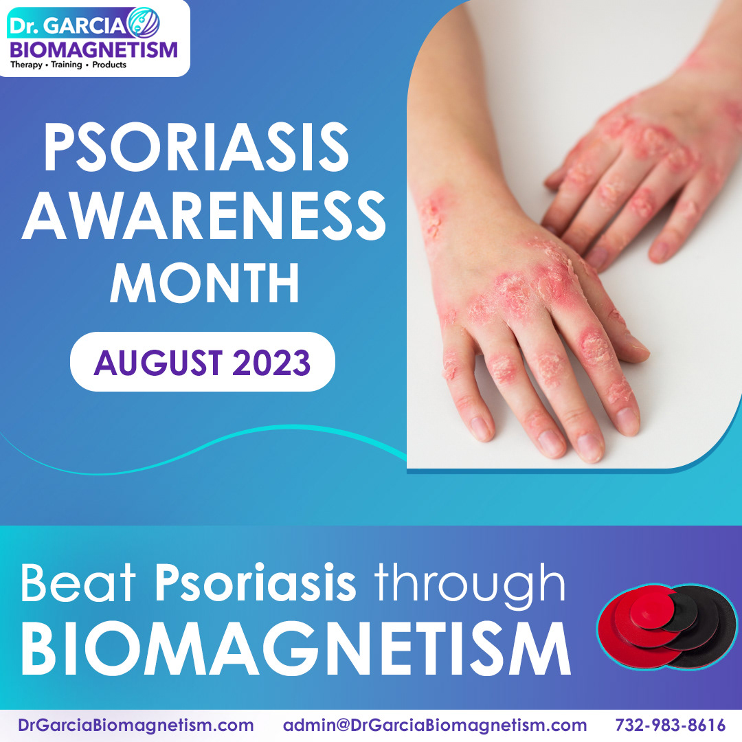 #PsoriasisAwareness #BiomagnetismTherapy #Holisticapproach