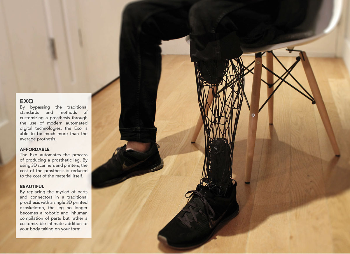 Prosthesis prosthetic leg 3d print exo skeleton Printing