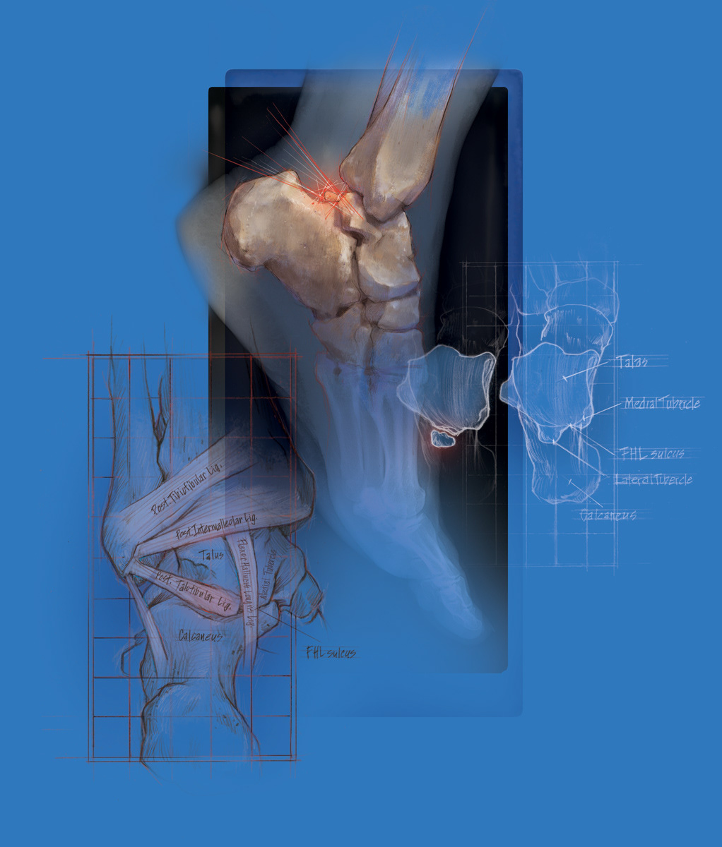 medical illustration ortho journal ILLUSTRATION  Scott Holladay Holladay Graphics Cover Art