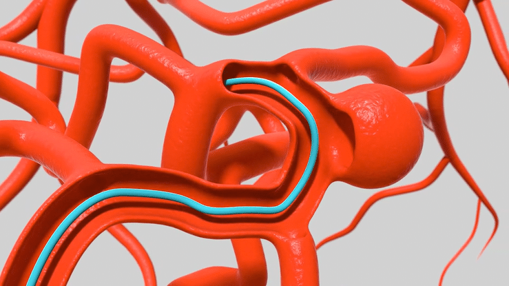 medical illustration scientific medical clinic medical device explainer video motion graphics  3d modeling Render 3D