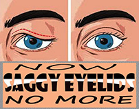 NOW SAGGY EYELIDS NO MORE