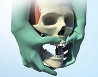 Surgical Animation for Education - Le Fort I Osteotomy on Behance