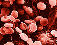 The Four Major Types of Red Blood Cell