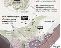 How Bacteria Affects the Body Infographic