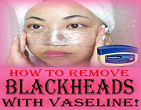 How To Remove Blackheads With Vaseline!