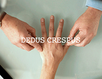 Dedus Crespus