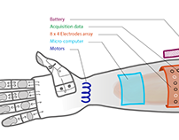 An intelligent prosthetic arm
