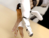 prosthetic robot finger for partial amputated patient