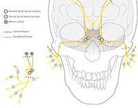 Neurological Conditions Affecting the Face