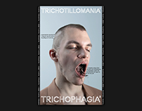 Trichotillomania - Trichophagia