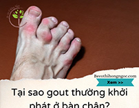 Nguyên nhân bàn chân là nơi khởi phát đầu tiên của Gout