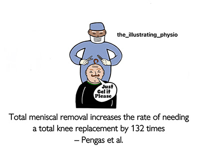 Save the meniscus
