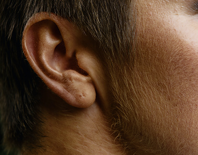 A Look at Autoimmune Inner Ear Disease