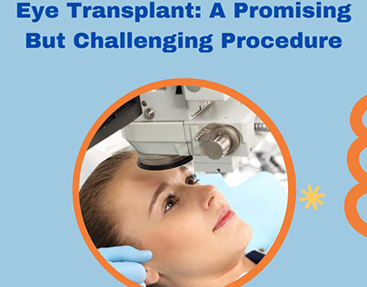 Eye Transplant: A Promising But Challenging Procedure