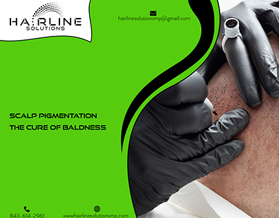 Scalp Pigmentation the Cure of Baldness