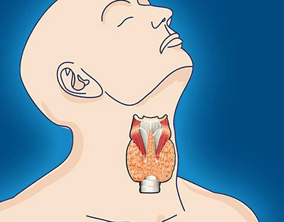 What Are The Symptoms of High Thyroid Levels