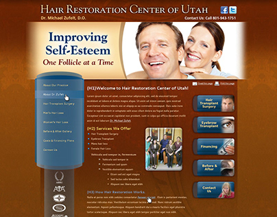 UI Wireframe Mockup - Hair Restoration Website
