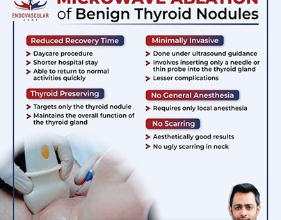 Project thumbnail - Microwave Ablation of Thyroid Nodules