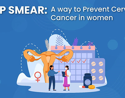 Pap Smear: A way to prevent cervical cancer in women