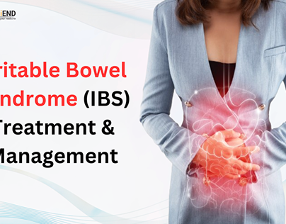 Irritable Bowel Syndrome (IBS) Treatment & Management