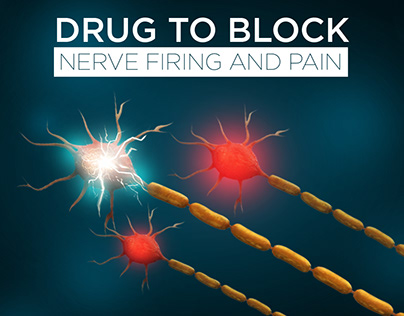 Nerve Firing and Pain Relief