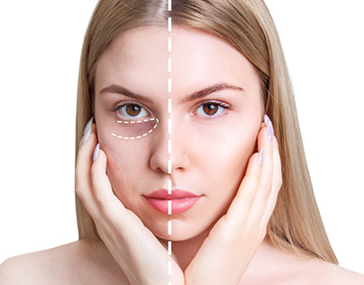 Aftercare Tips: Maintaining Your Cheek Filler Results