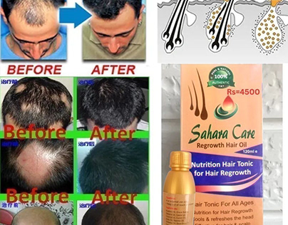 Sahara Care Regrowth Hair Oil in Lahore
