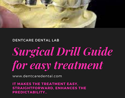 Surgical Guide for easy treatment and predictability