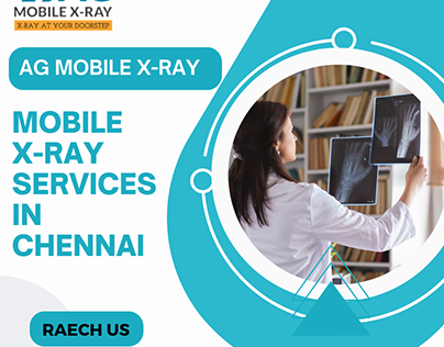 X-ray services in Chennai