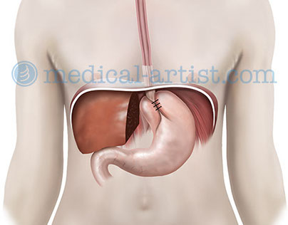 The gastrointestinal (GI) anatomy & pathology