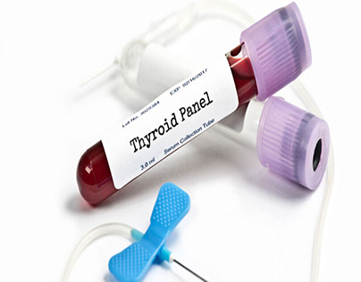 Thyroid Test Service in Tampa
