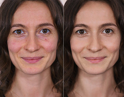 Skin retouching. Beauty retouching. Color correction