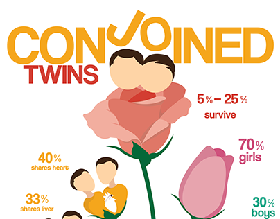 Infographic Design Conjoined Twins