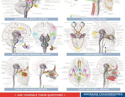 Poster for medical centers educating about Migraine