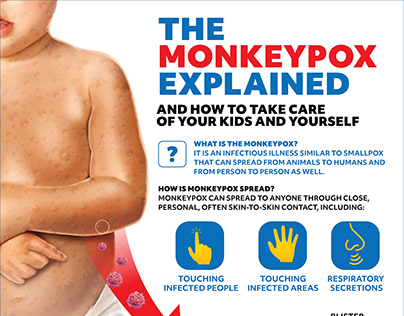 Monkeypox Infographic