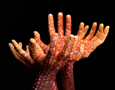 Coral Hands