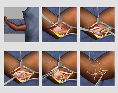 Surgical Illustrations