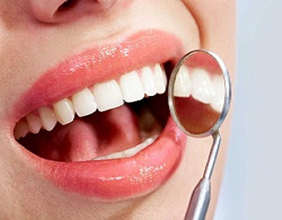 What Do Teeth Look Like Under Veneers?