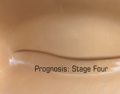 Prognosis_Stage Four